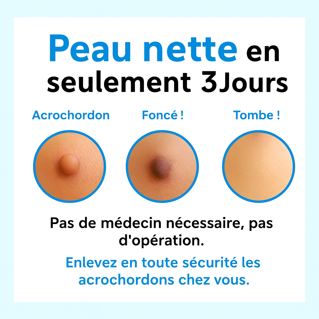 Alcura - Set complet