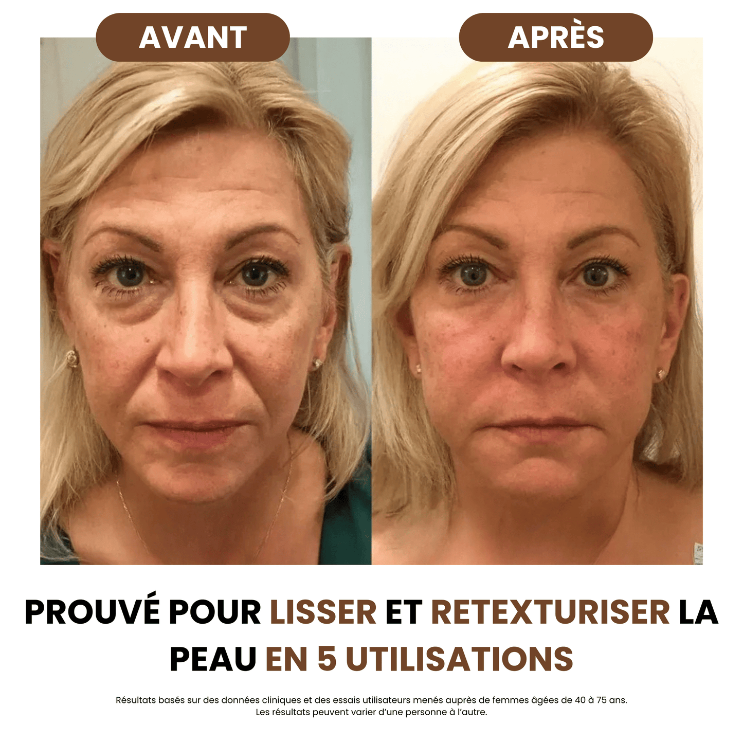 Lymphdrainage-Bürste