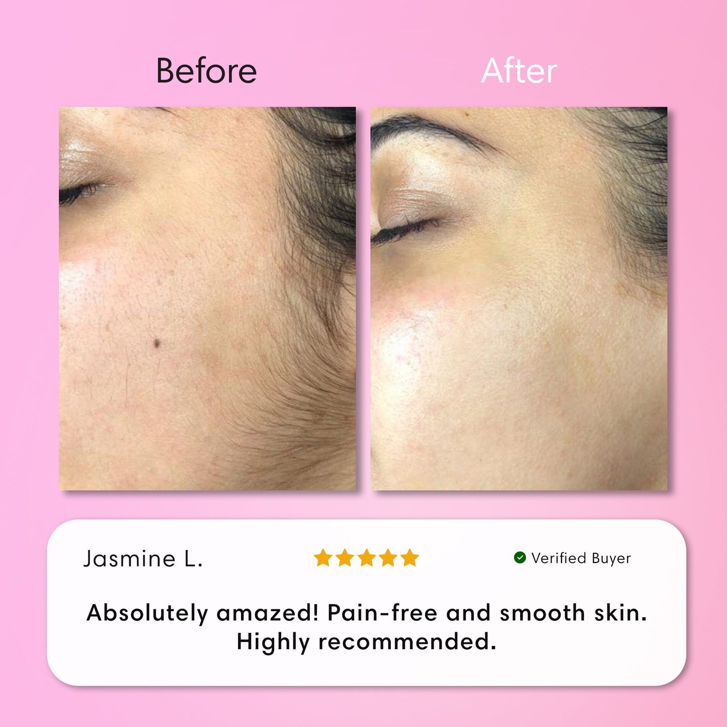 Instant Hair Removal Kit