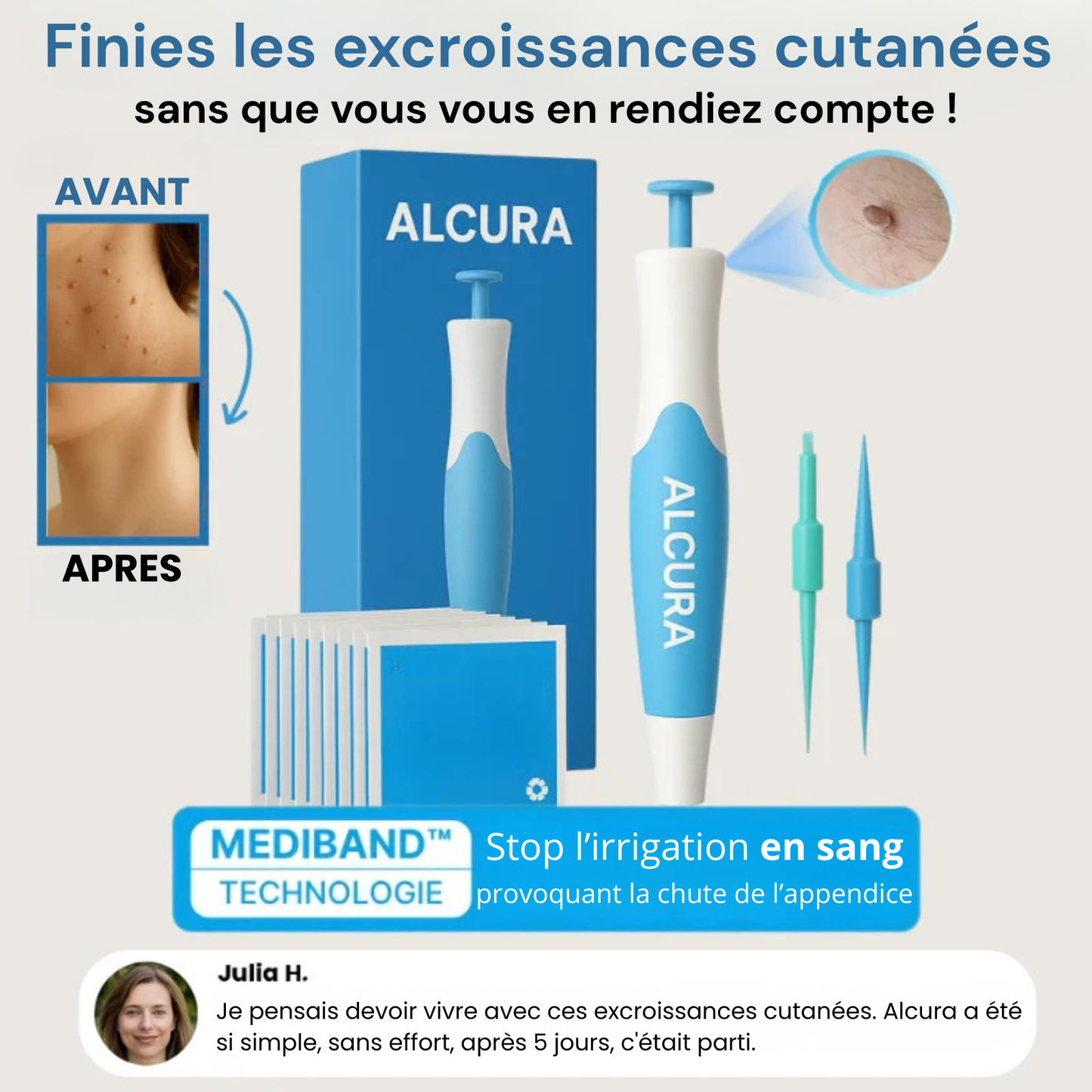 Alcura - Komplettes Set