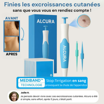 Alcura - Komplettes Set