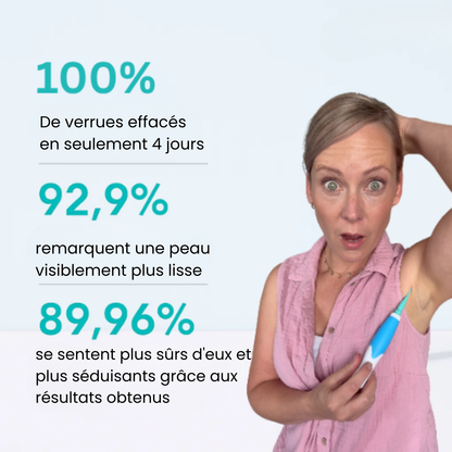 Alcura - Komplettes Set