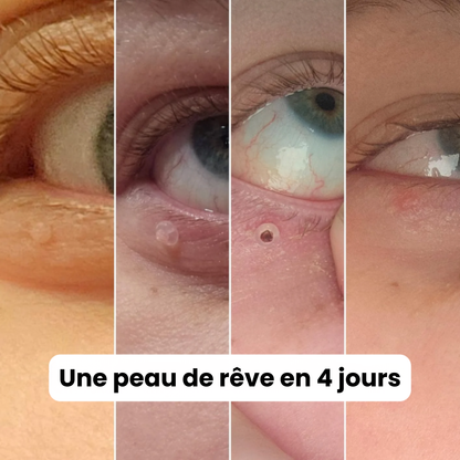 Alcura - Komplettes Set