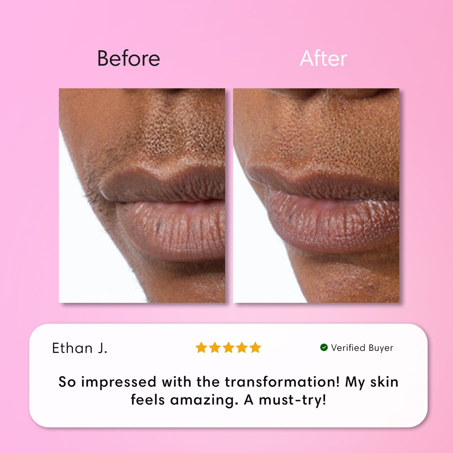 Instant Hair Removal Kit