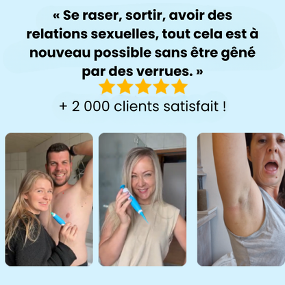 Alcura - Komplettes Set