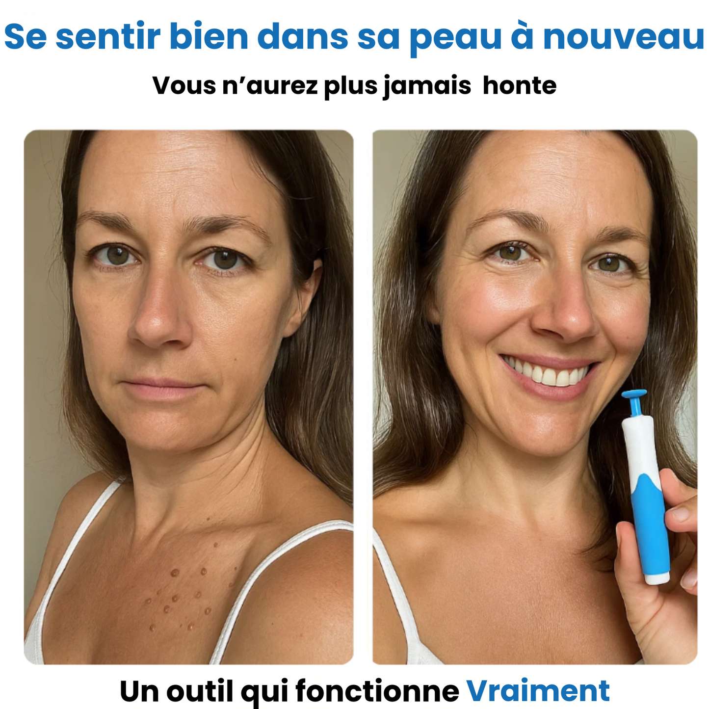 Alcura - Komplettes Set