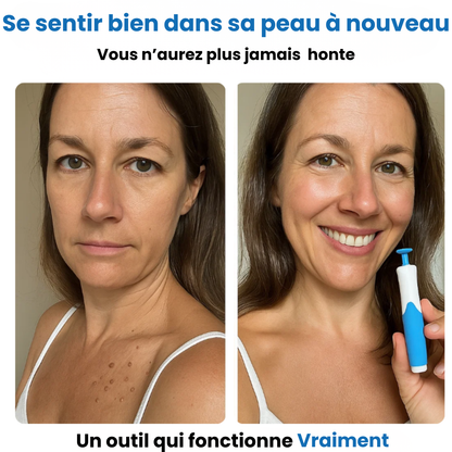 Alcura - Komplettes Set