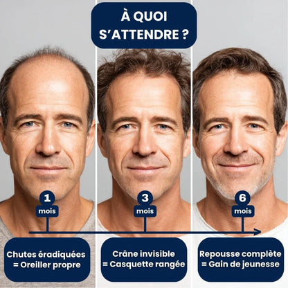 Collagix Micro Infusion - Haar-Regeneration