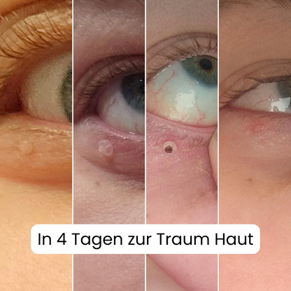 Alcura - Set complett