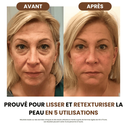 Lymphdrainage-Bürste