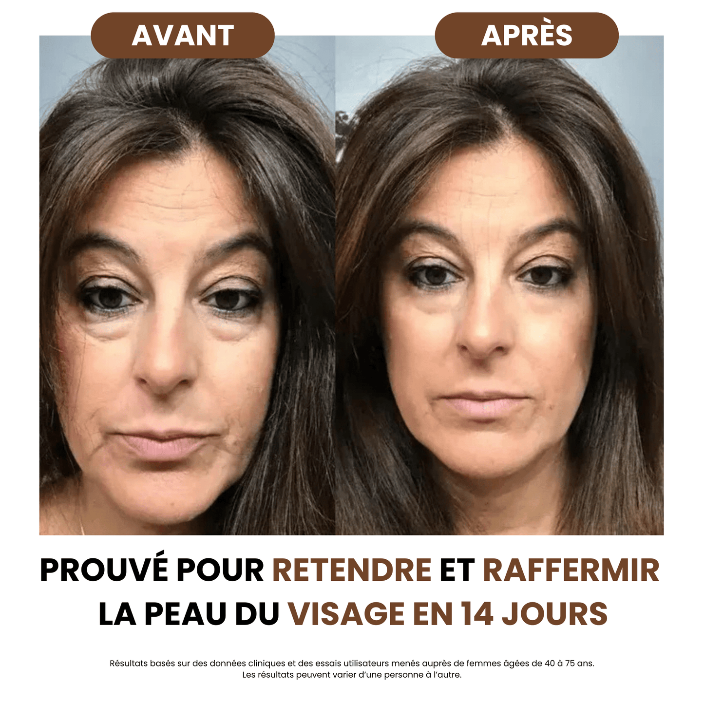 Lymphdrainage-Bürste