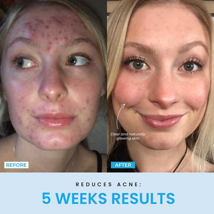 Liftlab Sculptor + Free Serum..