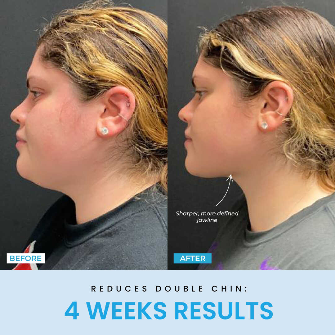 Liftlab Sculptor + Free Serum..