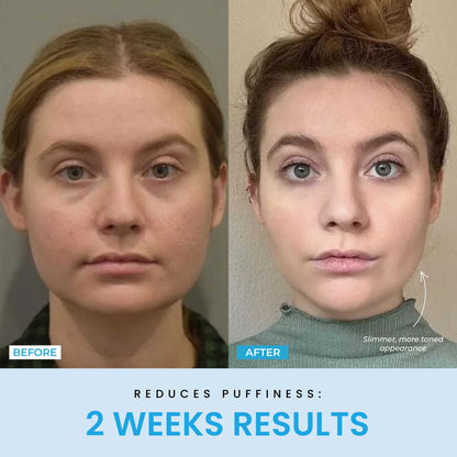 Liftlab Sculptor + Free Serum..