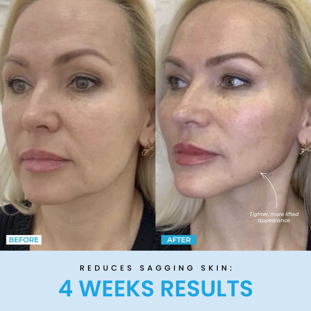 Liftlab Sculptor + Free Serum..