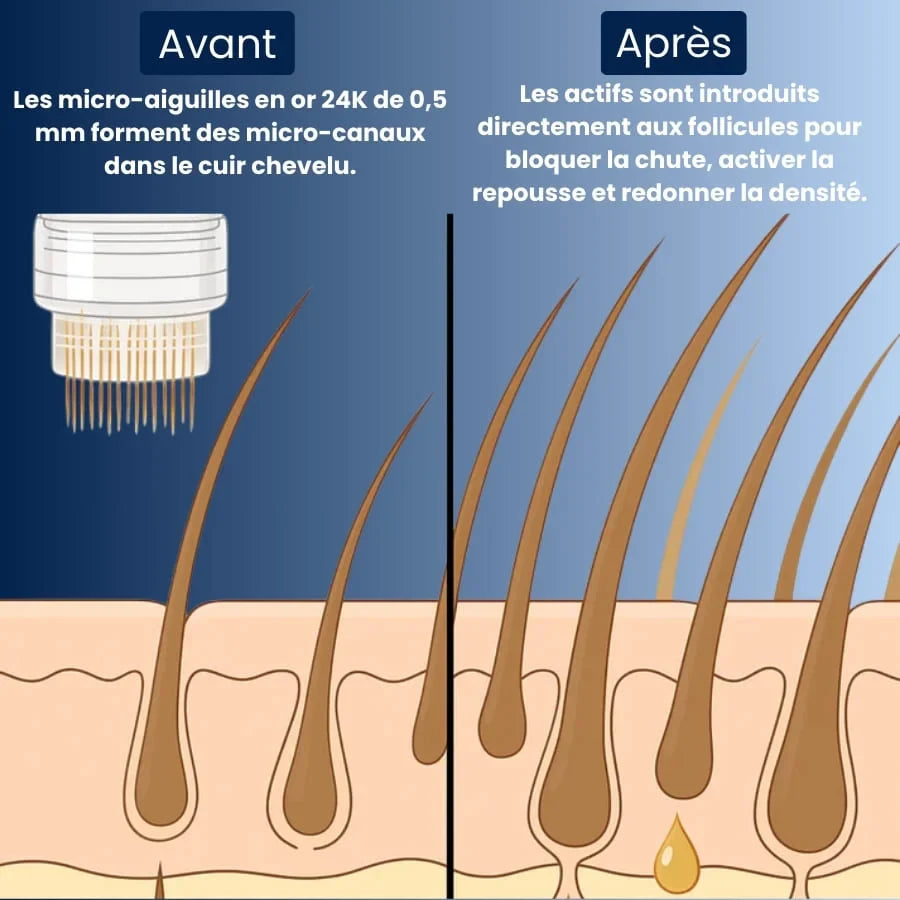 Collagix Micro Infusion - Haar-Regeneration