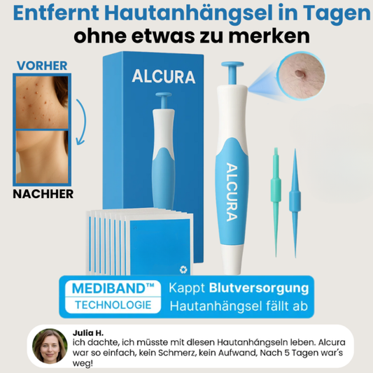 Alcura - Set complett