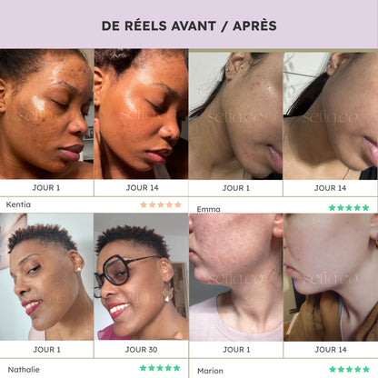 Reinigungswatte Kurkuma & Vitamin C