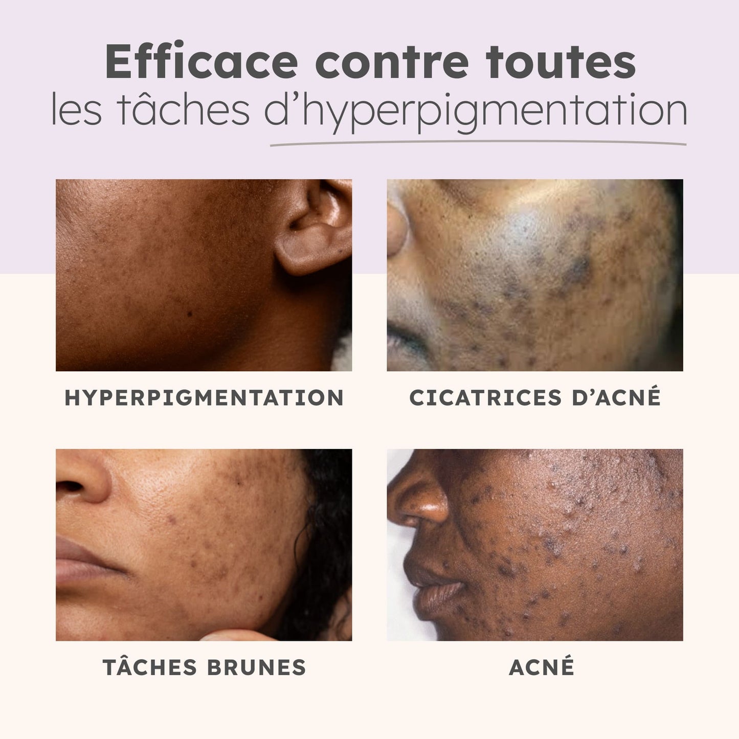 Reinigungswatte Kurkuma & Vitamin C